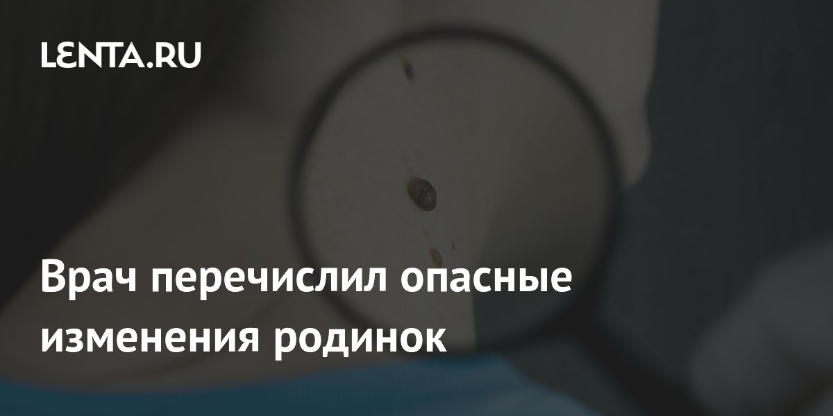 Опасные изменения родинок: врач объяснил, когда пора к дерматологу