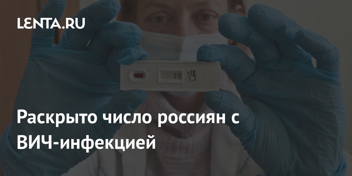 Минздрав раскрыл число россиян с ВИЧ: более 930 тысяч пациентов