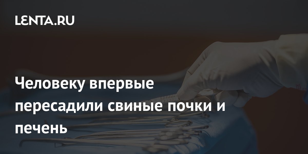 Китайские врачи впервые пересадили человеку свиные почки и печень