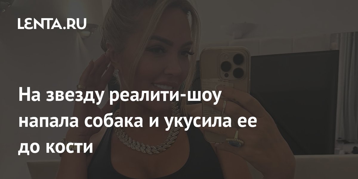 Участницу «Большого брата» укусила собака до кости Участницу «Большого брата» укусила собака до кости