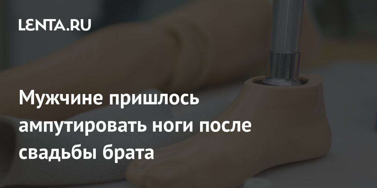 Американцу ампутировали ноги из-за инфекции на свадьбе: как уберечься в поездке