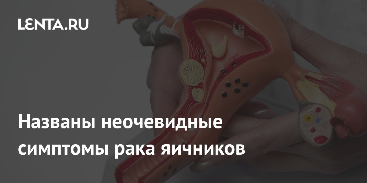 Врач перечислил неочевидные симптомы рака яичников: вздутие и запоры