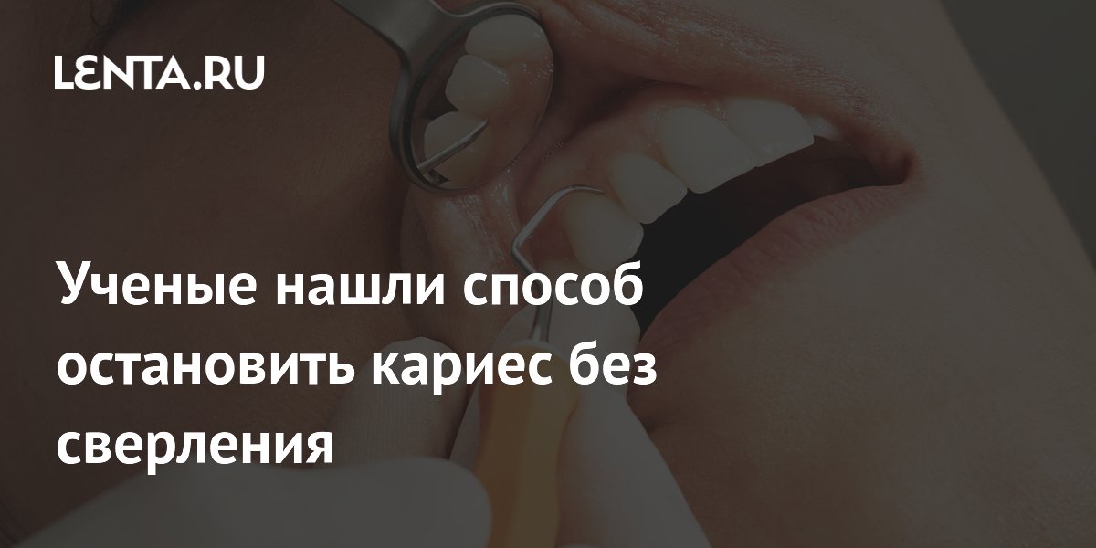 Раствор вместо бормашины: ученые нашли способ остановить детский кариес