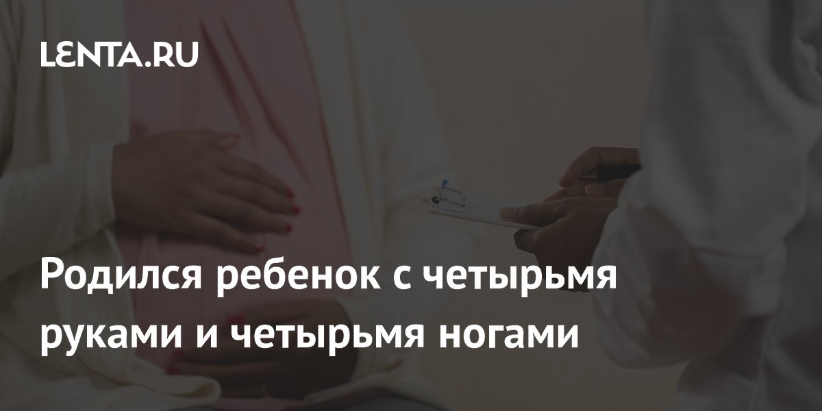 В Индии родился ребенок с четырьмя руками и ногами: врачи готовят обследование В Индии родился ребенок с четырьмя руками и ногами: врачи готовят обследование