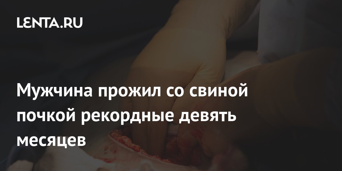 Мужчина с пересаженной свиной почкой прожил рекордные девять месяцев Мужчина с пересаженной свиной почкой прожил рекордные девять месяцев